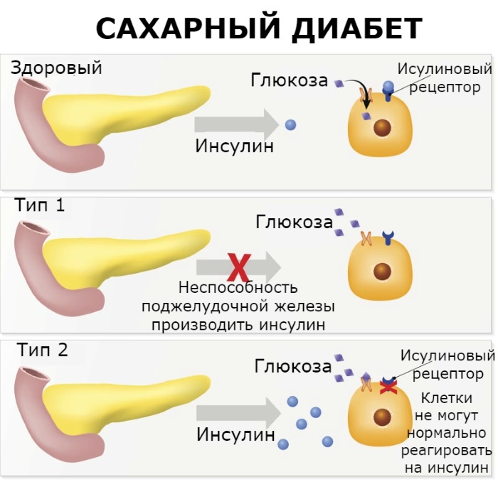 Мерзнут ноги. Причины у женщин, к какому врачу обратиться, что лечить