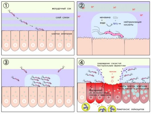 Схема лечения гастрита у взрослых