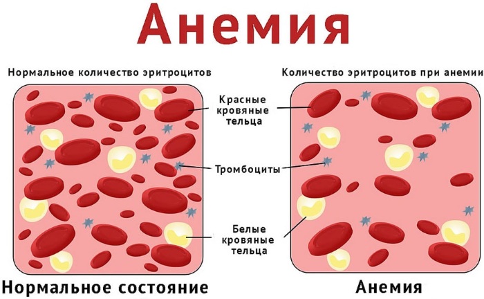 Общий анализ крови. Норма по возрасту, полу у взрослых, детей. Расшифровка результатов