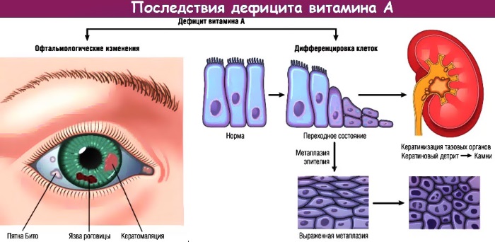 Кератодермия ладоней и подошв. Лечение у взрослых, детей. Мази, народные средства