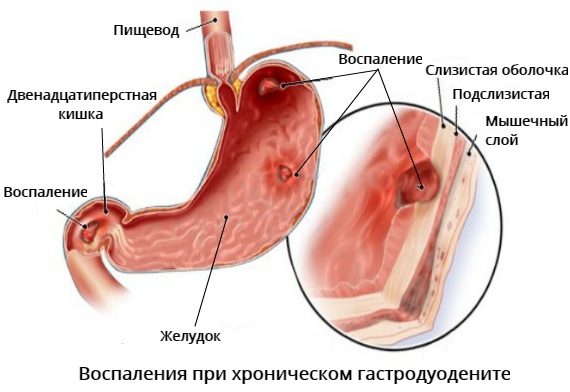 Шанк Пракшалана. Как правильно делать упражнения, питание, очищение. Отзывы. Видео