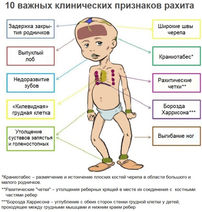 Вальгусная стопа у ребенка. Фото, лечение, массаж, ЛФК, таблетки, процедуры