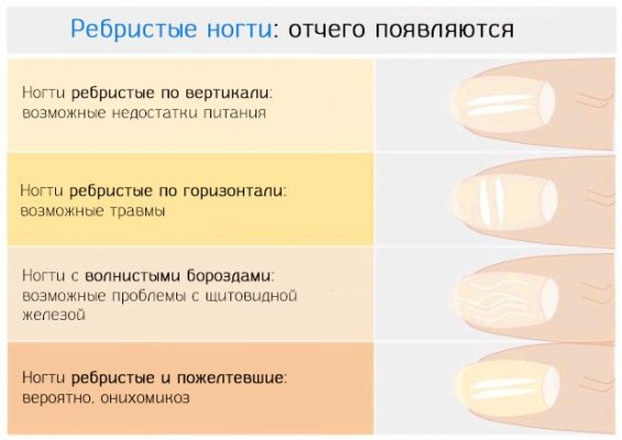 Заболевания ногтей на ногах таблица описание фото