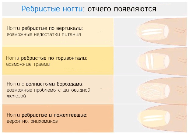 Инфекция на ногах фото