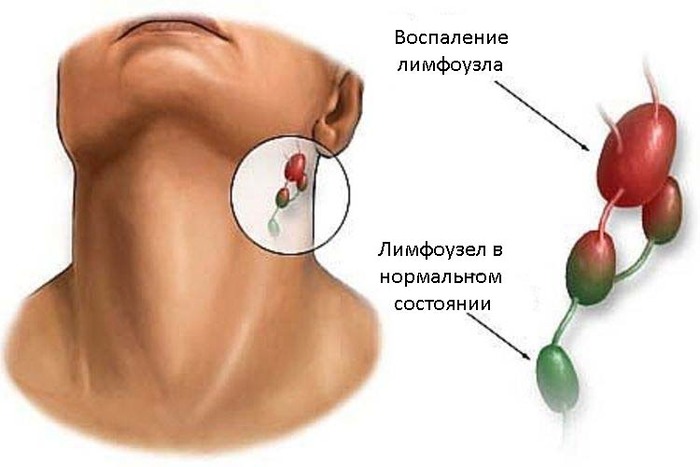 Болезни, передающиеся половым путем. Инфекционные, венерические, смертельные. Симптомы и лечение