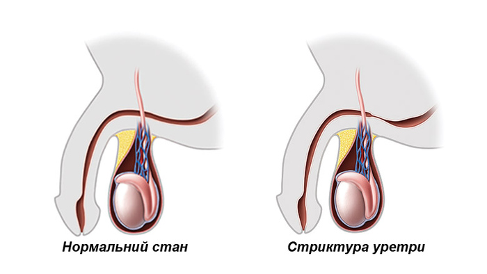 Болезни, передающиеся половым путем. Инфекционные, венерические, смертельные. Симптомы и лечение