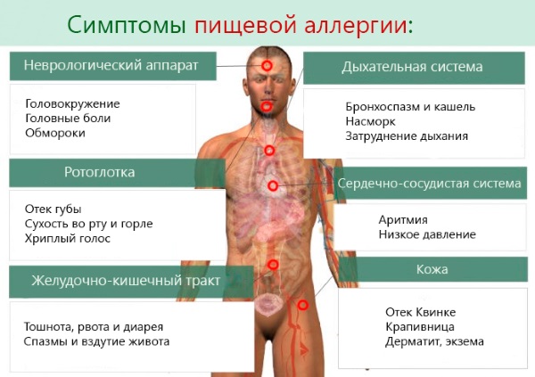 Эритема. Что это такое, фото, симптомы и лечение. Многоформная, узловатая, эритематозная сыпь