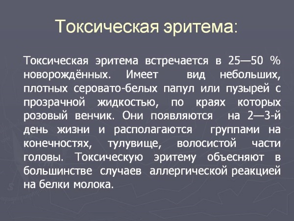 Эритема. Что это такое, фото, симптомы и лечение. Многоформная, узловатая, эритематозная сыпь