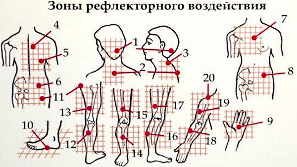 Лечение остеохондроза шейного отдела в домашних условиях мазями, ЛФК, народные средства, процедуры