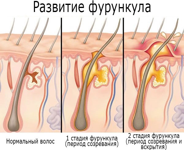 Синтомициновая мазь. Инструкция по применению, цена, аналоги, отзывы