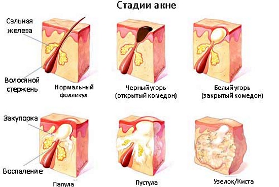 Синтомициновая мазь. Инструкция по применению, цена, аналоги, отзывы