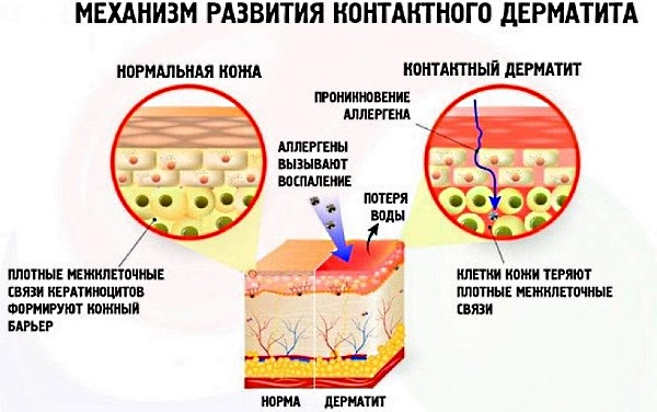 Синтомициновая мазь. Инструкция по применению, цена, аналоги, отзывы