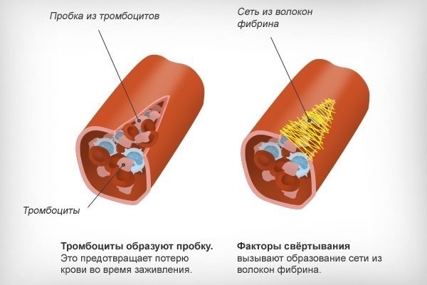 Повышенные тромбоциты в крови у женщин. Причины и лечение, что это значит