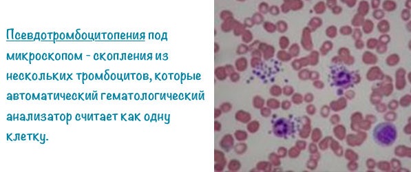 Повышенные тромбоциты в крови у женщин. Причины и лечение, что это значит