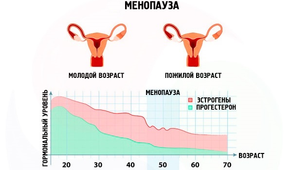 Климакс у женщин. Что это такое, причины, признаки по возрасту, стадии, лечение