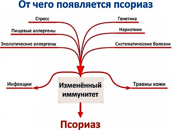 Псориаз фото причины лечение