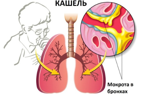 Стоптуссин от кашля. Инструкция по применению, цена, аналоги, отзывы