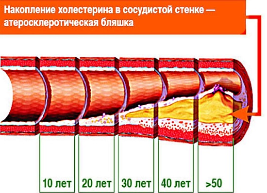 Триглицериды повышены. Что это значит, норма в крови. Строение, функция, простые и смешанные, уровень в анализе