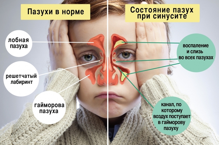 Ципролет. Инструкция по применению таблетки 500 мг. Цена, аналоги