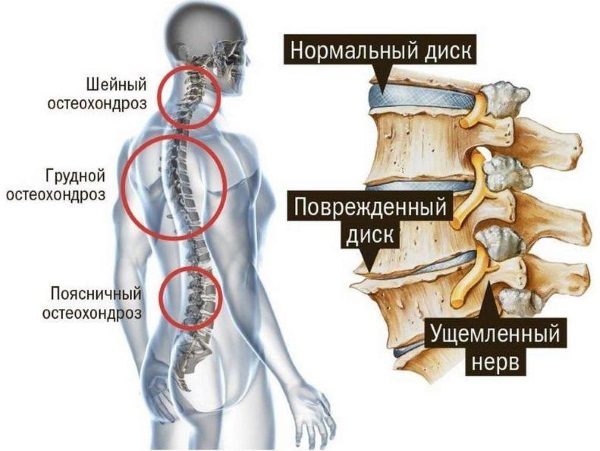 Боль под левой грудиной у женщин спереди при дыхании, движении, нажатии, после еды. Причины и что делать