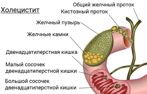 Боль в правом подреберье спереди. Причины, возможные заболевания. Лечение, диагностика