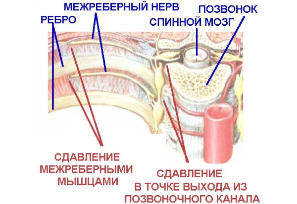 Боли в спине в области лопаток. Причины, лечение – препараты и упражнения