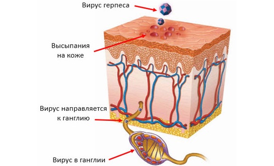 Линейный дерматит у ребенка фото thumbnail