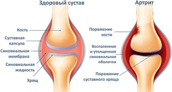 Нанопластырь Нанопласт Форте. Инструкция по применению. Цена, аналоги