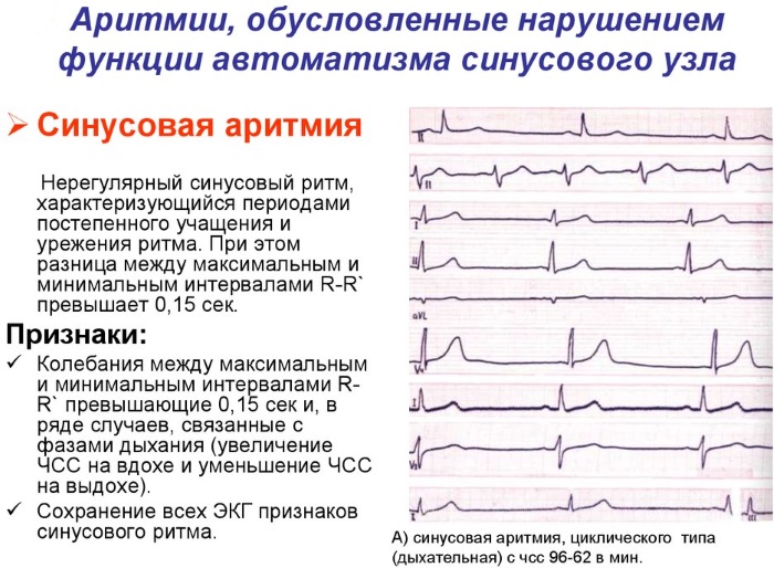 Сердцебиение у женщин и мужчин. Норма в минуту, как измерить пульс, что делать при отклонении