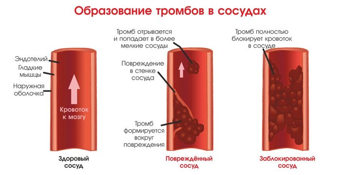 Аргинин. Инструкция по применению. Цена, аналоги, отзывы