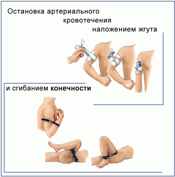 Какой признаки характеризуют артериальное кровотечение