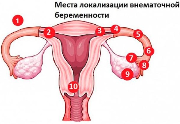 Болит низ живота справа у женщины, что это, как лечить, если ноет, отдает в ногу, причины