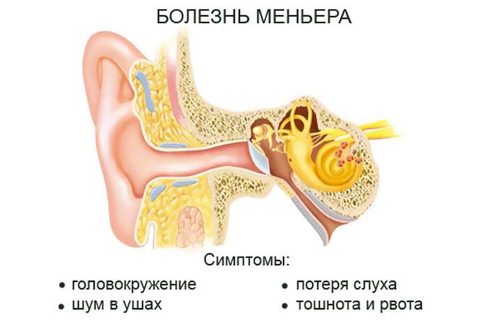 Болит ухо с одной стороны. Чем лечить: лекарства, антибиотики, капли