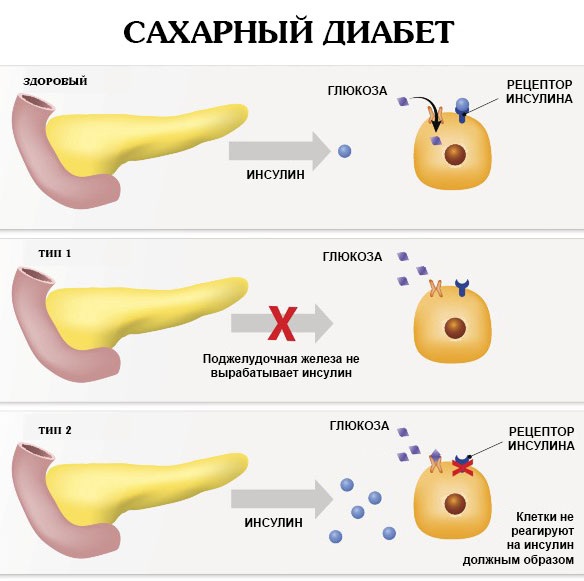 Болячки на голове в волосах. Фото, причины и лечение в домашних условиях