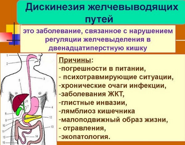 Дискенизия желчегонных путей. Симптомы и лечение народными средствами, препараты, диета