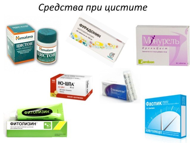 Эффективные народные и аптечные средства от цистита у женщин. Названия, цены, как применять