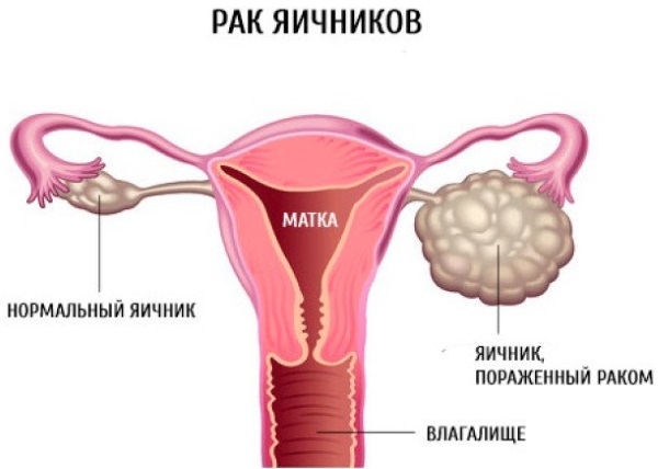 Фемостон 1\10, 2\10. Инструкция по применению, цена, аналоги