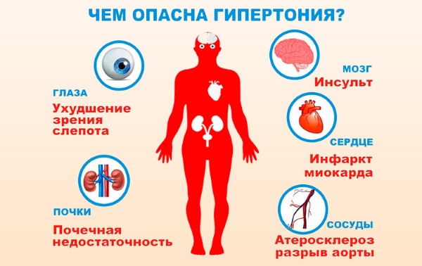 Гидроцефалия головного мозга у взрослых. Лечение, что такое заместительная, умеренная, внутренняя. Признаки