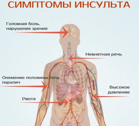 Гидроцефалия головного мозга у взрослых. Лечение, что такое заместительная, умеренная, внутренняя. Признаки