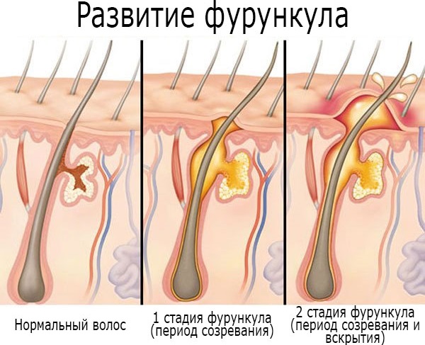 Коровяк трава. Лечебные свойства растения, как готовить, принимать, рецепты и противопоказания