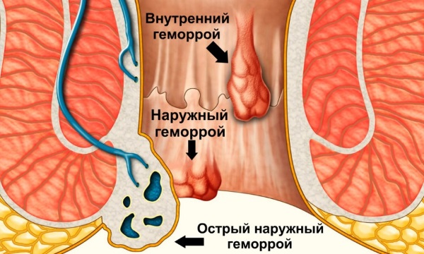Коровяк трава. Лечебные свойства растения, как готовить, принимать, рецепты и противопоказания
