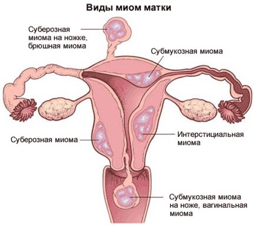 Кровянистые выделения в середине цикла межменструальные, темные, при приеме противозачаточных