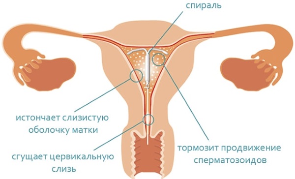 Месячные 2 раза в месяц. Причины после 40 лет, у подростков, после отмены Дюфастона, Постинора, при беременности