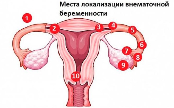 Месячные 2 раза в месяц. Причины после 40 лет, у подростков, после отмены Дюфастона, Постинора, при беременности