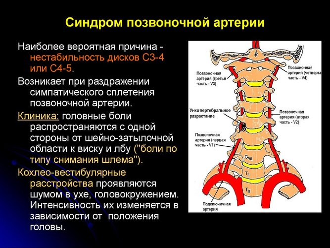 Синдрома нестабильность шейного отдела позвоночника. Симптомы и лечение, рентген, клинические рекомендации