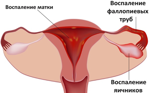 Почему нет месячных и нет беременности. Причины и что делать