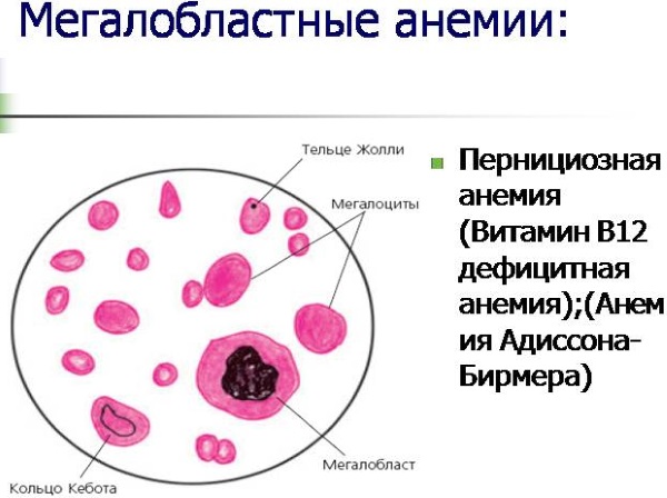 Низкие тромбоциты в крови. Причины и последствия у детей, взрослых, беременных. Лечение