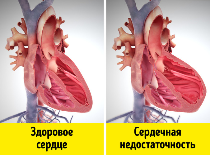 Отеки на лице. Причины по утрам, при беременности, от аллергии. Лечение