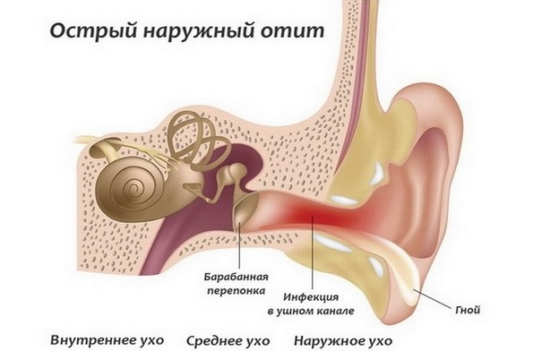 Стреляет в ухе с левой стороны. Причины и лечение, что дел</p></div><div class=