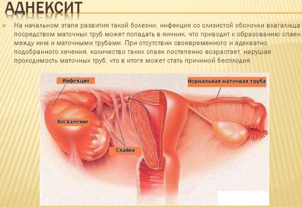 Тянущая боль внизу живота у женщин. Причины перед месячными, во время беременности